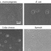 Bacterial microcolony and Feed Debris 